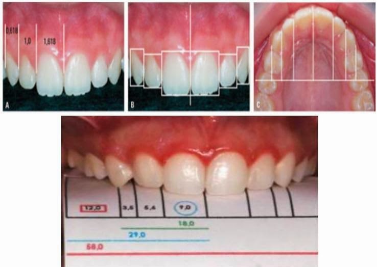 Fibonacci na dentição humana